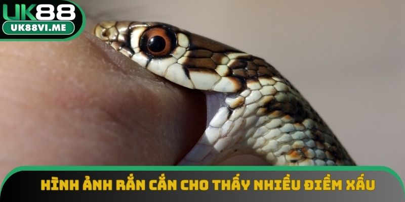 Hình ảnh rắn cắn cho thấy nhiều điềm xấu